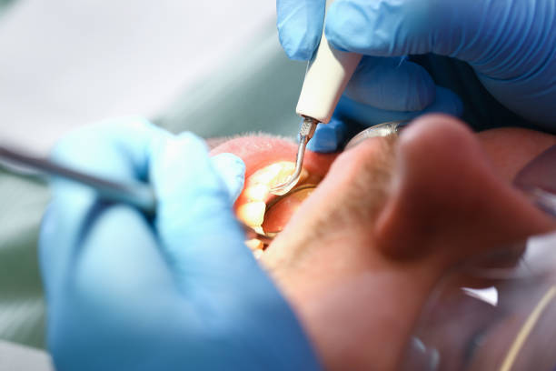 Best Emergency Broken Tooth Repair in Trappe, PA